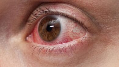 Ciplox Eye Drops