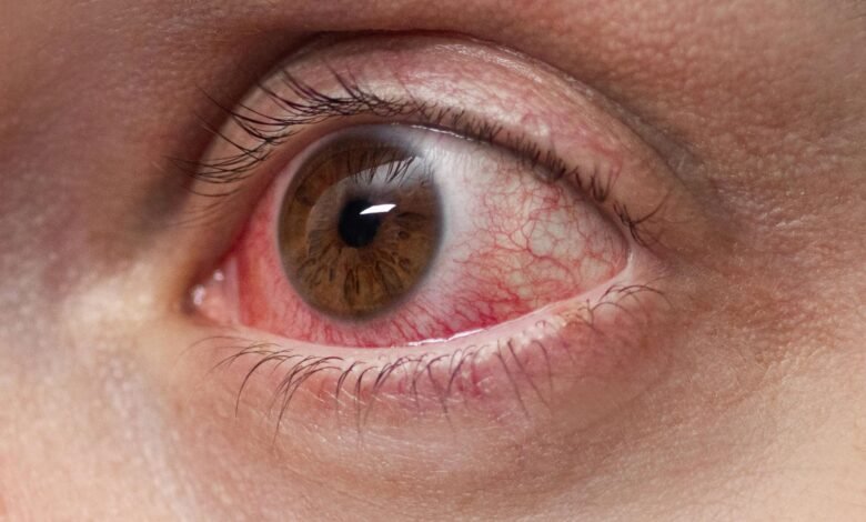 Ciplox Eye Drops