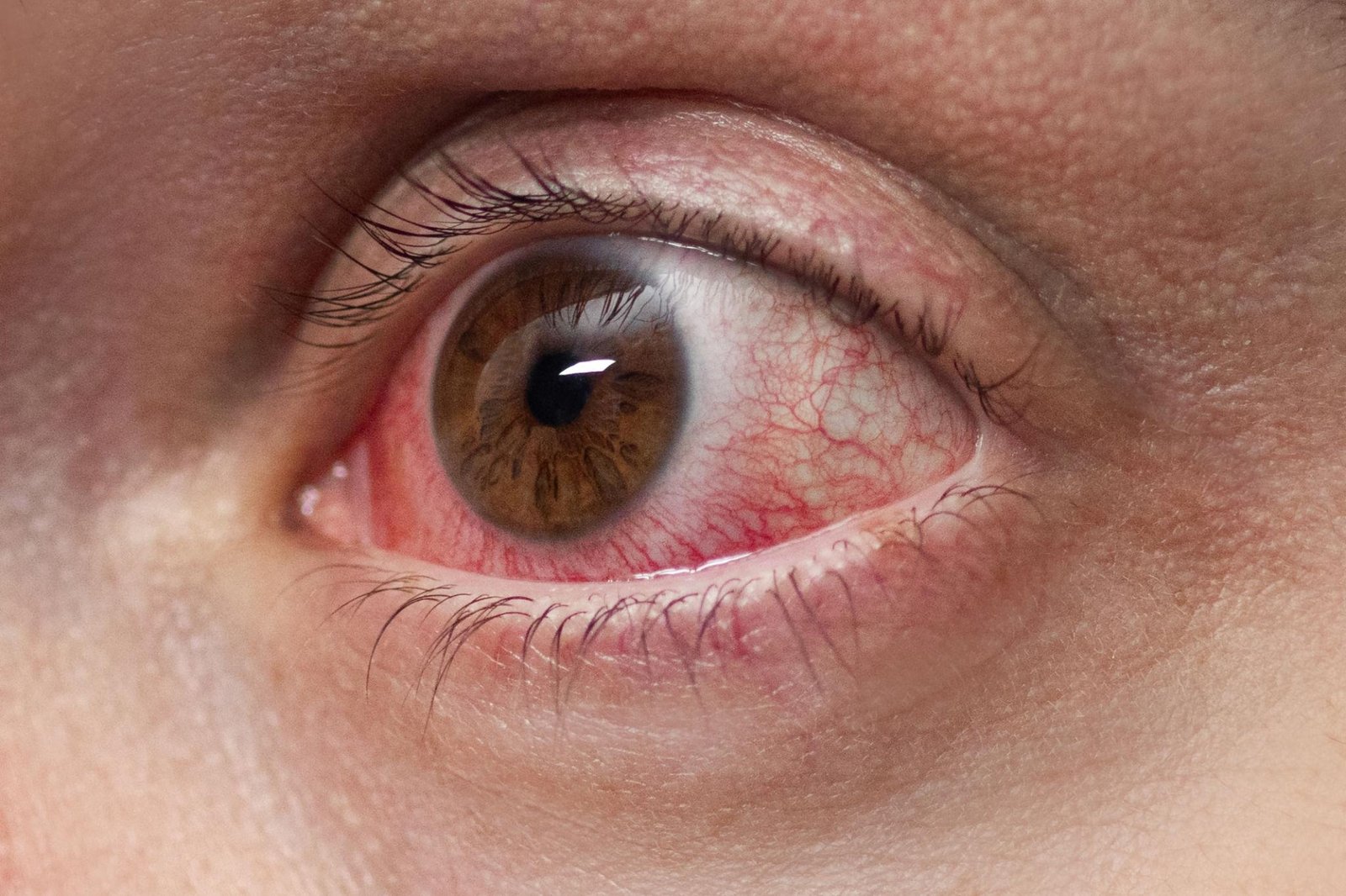 Ciplox Eye Drops